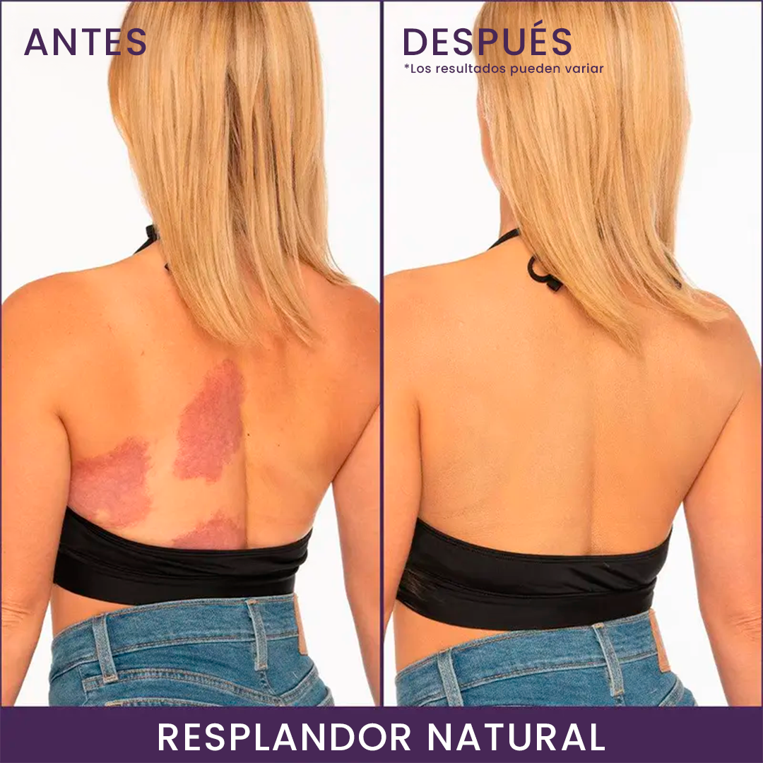 Perfeccionador de Cobertura Corporal